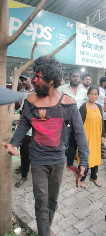 Mentally unstable person attacked woman with stone while walking on roadside in Sahakarnagar